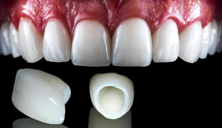 QQ20230523164232 QQ20230523164232